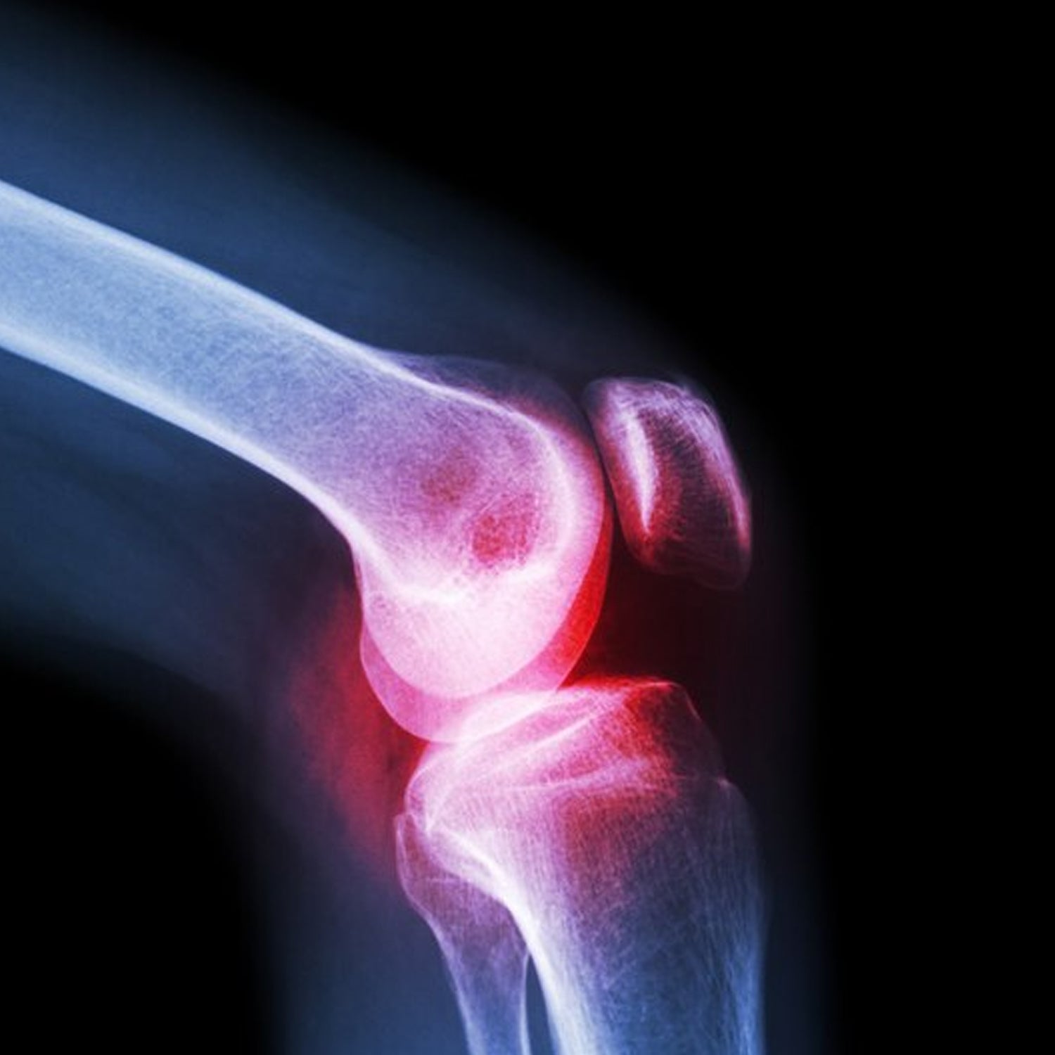 Knee cap for joint support, large size Knee cap for joint support, large size